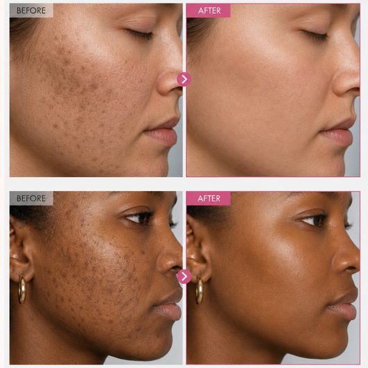 Korean Advanced Arbutin Glow Cream